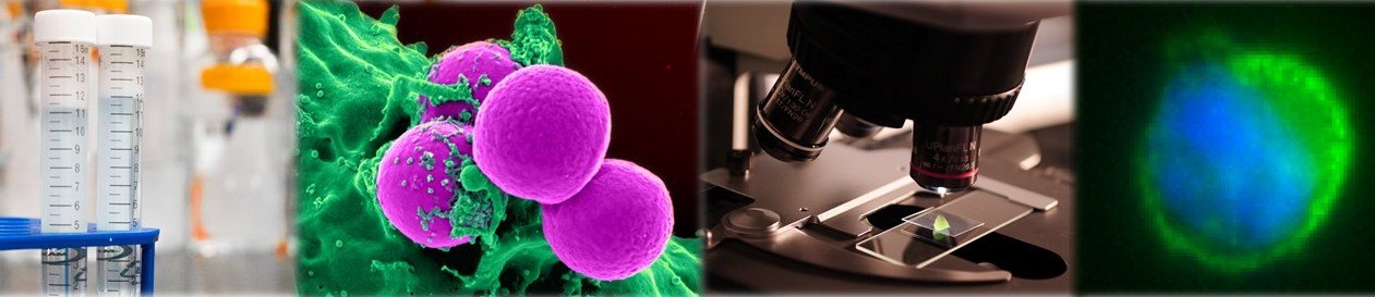 Máster Universitario en Investigación en Inmunología